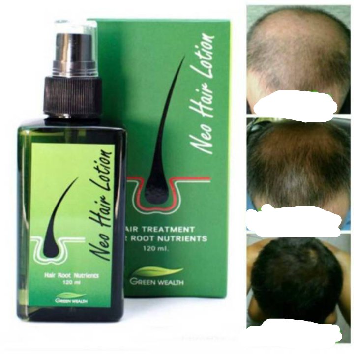 L\'huile anti-chauve