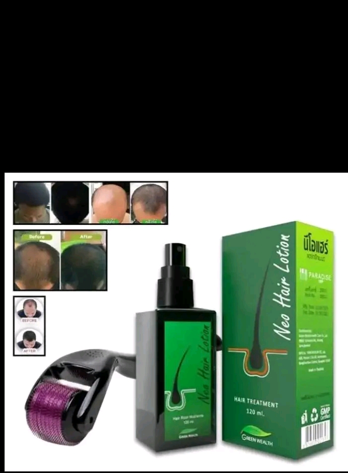 L\'huile anti chauve (salida bidarta)